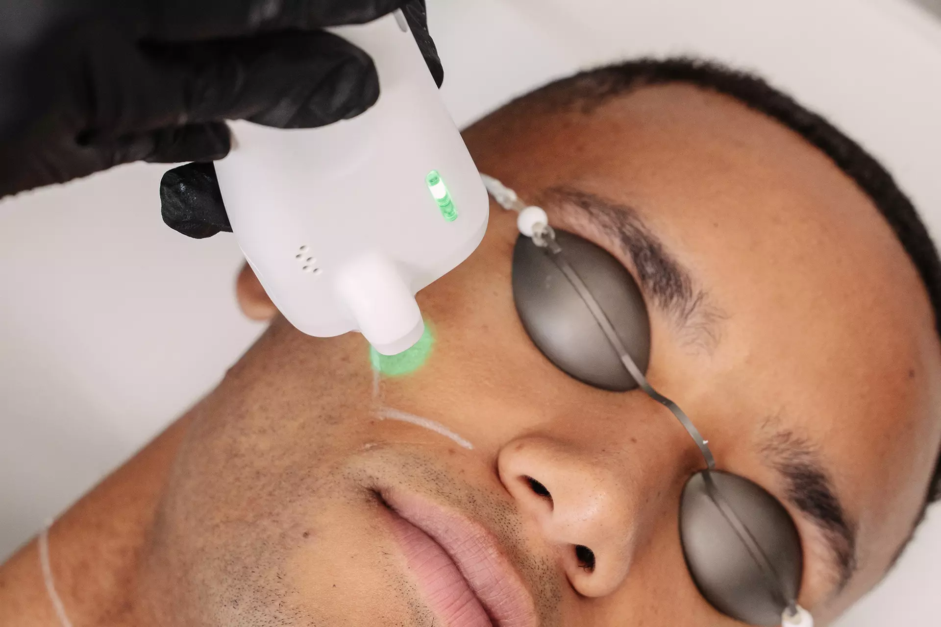 Laser-Haarentfernung an 1 kleinen / großen Zone nach Wahl für 1 Person