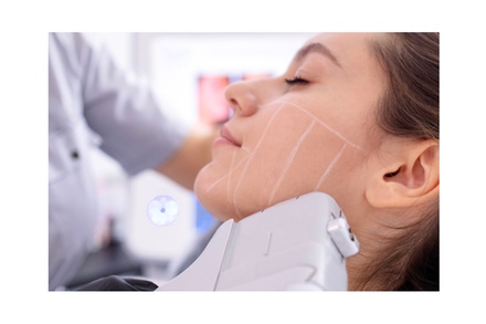 50% Off Double Chin HIFU - Skin Sculpt Clinic
