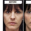 Image 4: 1/2, 1, 2, or 4 Vials of Sculptra Collagen-Stimulating Injectables