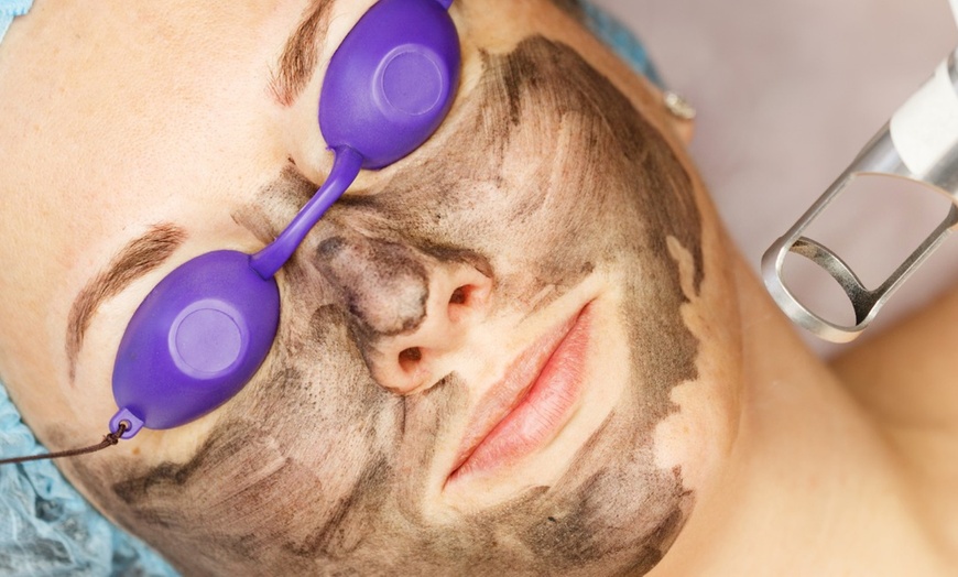 Image 4: Get Glowing Skin with 1 or 6 Sessions of Carbon Laser Peel Facial at Agatha K Micropigmentation (Up to 48% Off)