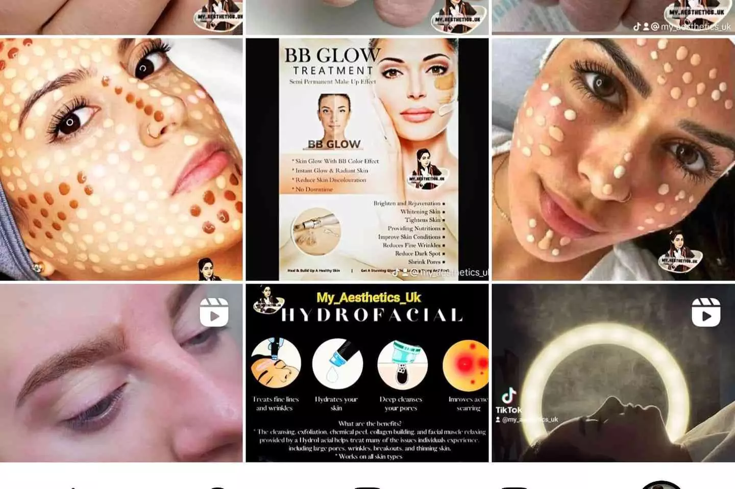 Restore Your Radiance with 1 or 2 Luxury Microneedling Sessions