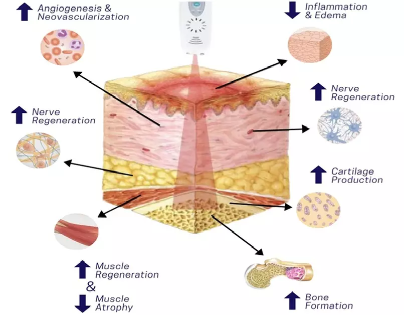 Laser & Shockwave Therapy Combo + Deep Tissue Massage — Relieve Pain, Restore Balance! (Up To 60% Off)