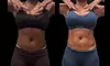 Sculpt Your Body w/ 2 or 3 Fat Dissolver Sessions or 1 Fat Dissolver and More at Southern Shapez (Up to 55%Off)