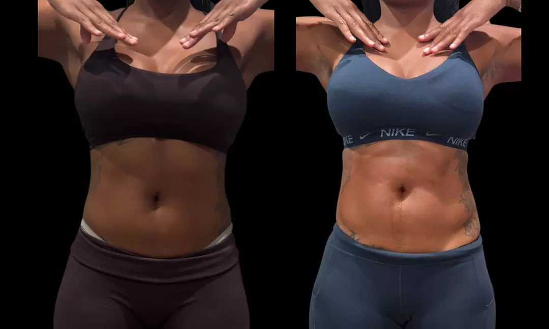 Two or Three Fat Dissolver Sessions or One Fat Dissolver and More