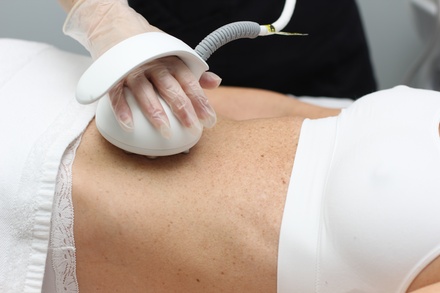 One RF Body-Contouring and Cellulite Reduction - 4D Skin Care Clinic