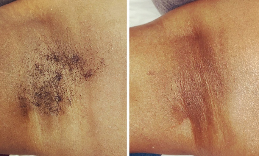 Image 1: Waxing at Benevolent Elegance Esthetics