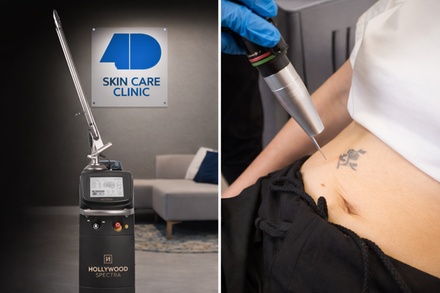 One Tattoo-Removal Session on an Area up to Two Square Inches - 4D Skin Care Clinic