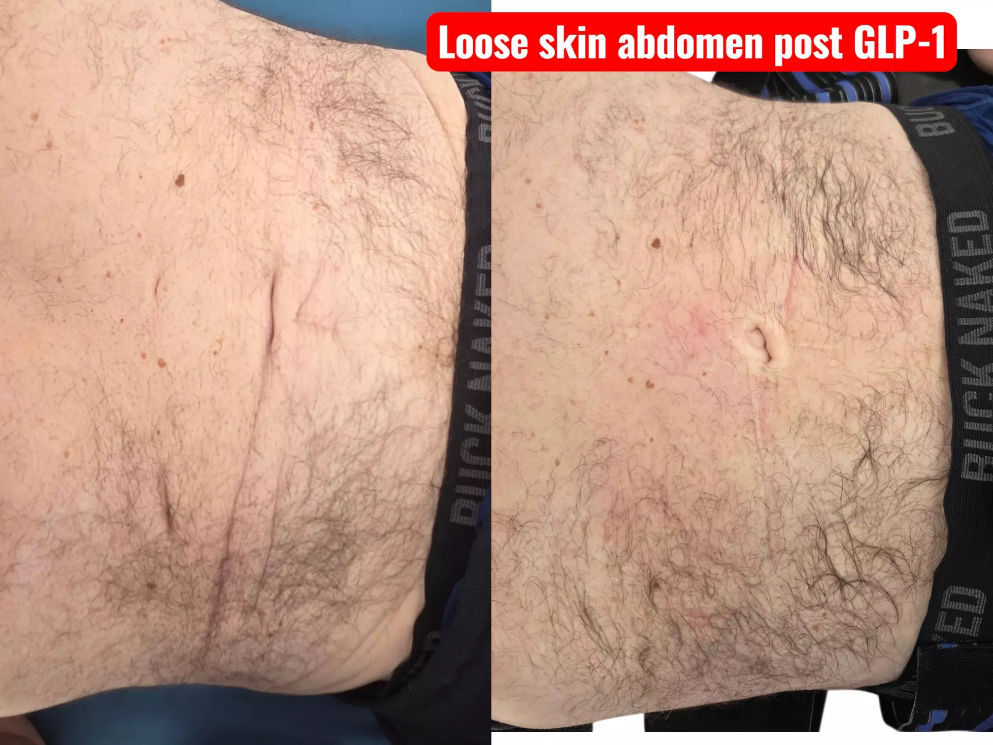 Build Muscle, Tone, and Reduce Fat for a Contoured Look