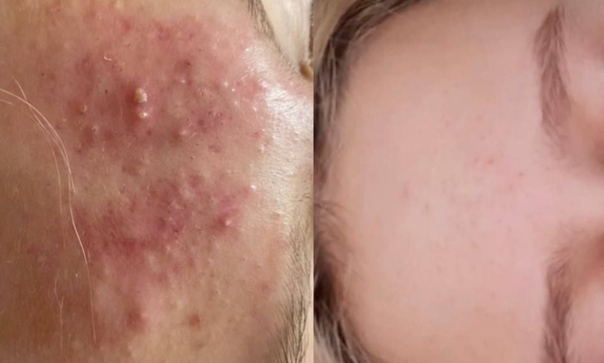 Image 2: Bis zu 56% Rabatt auf den Kosmetische Gesichtsbehandlung bei Gym for skin Kosmetiksalon