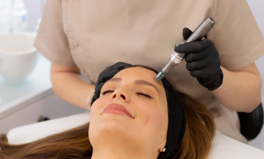 Image 1: Up to 60% Off on Micro-Needling at Modern Wellness & Beauty