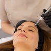 Image 1: Up to 60% Off on Micro-Needling at Modern Wellness & Beauty