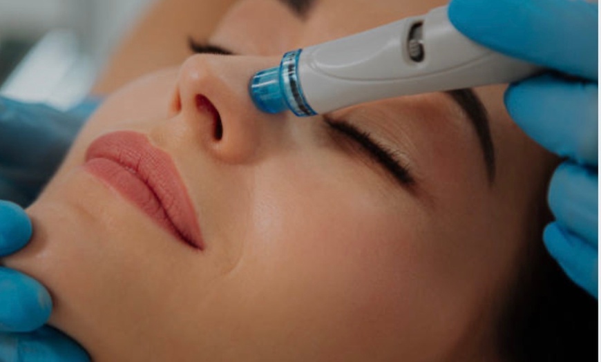 Image 5: Up to 67% Off on Facial at Let's May Skin Care Center