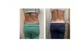 Up to 63% Off on Fat Reduction - Non-Branded at Your Sculpt Studio - Second Medium