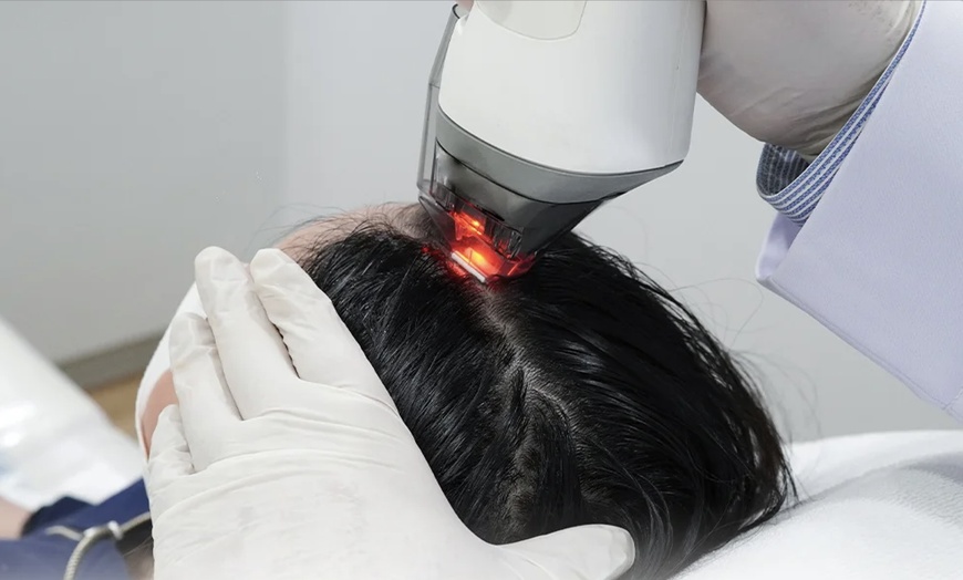 Image 1: 1, 2, or 3 Exosome Stem Cell or Hair Restoration w/ Thulium RF & More
