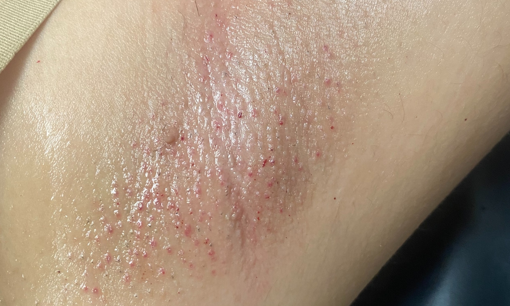 Enhance Your Look with Lip waxing