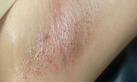 no more bumps glow feels fresh smooth underarms  - The Waxing Mystery