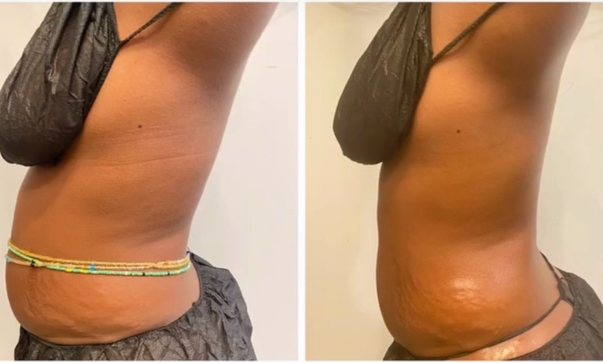 Image 5: One Hour Full Body Lymphatic Rub at Sound Sculpting Solutions