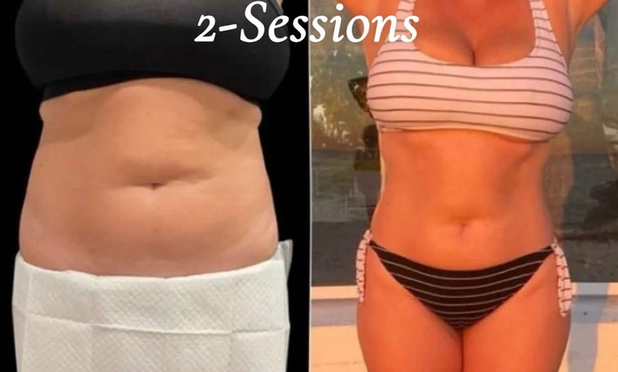Image 1: Up to 60% Off on Ultrasonic Fat Reduction at Dream beauty and med spa