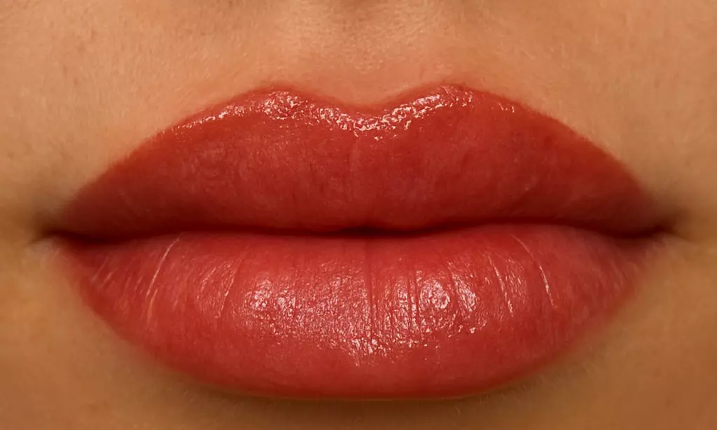 Up to 45% Off on Lip Enhancement at Blaké Aesthetics - Second Medium