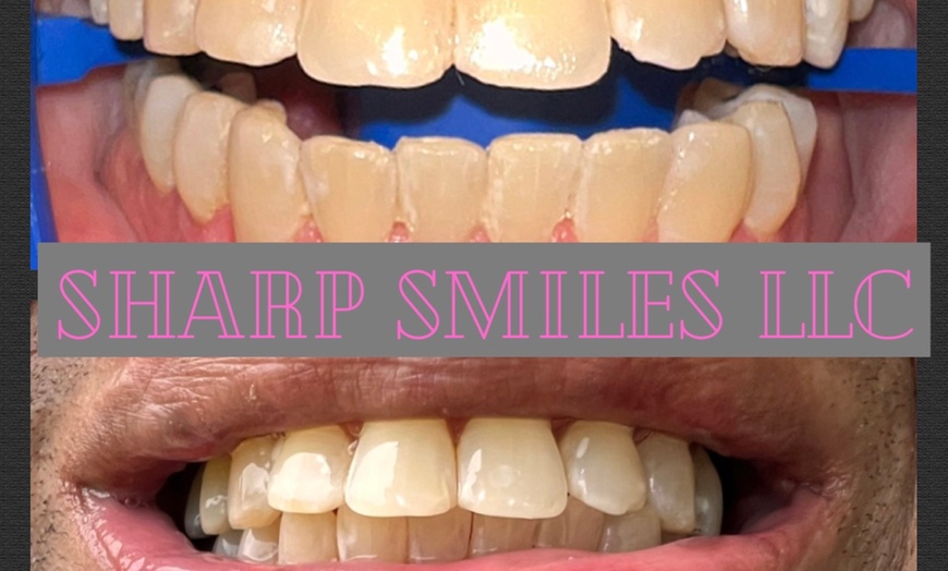 Image 5: Brighten Your Smile With Teeth Whitening, Polishing & More 
