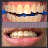 Image 5: Brighten Your Smile With Teeth Whitening, Polishing & More 