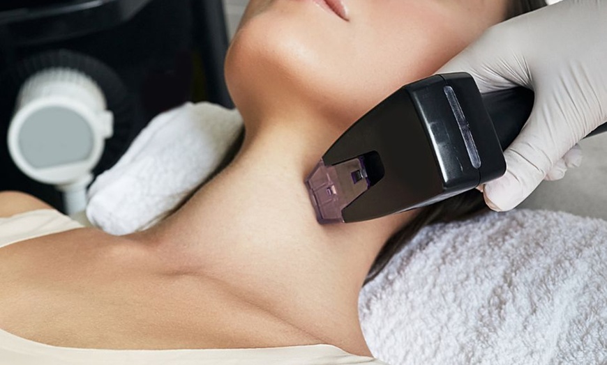Image 2: Morpheus8 with Bonus Cryo-Cooling Therapy