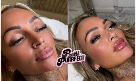 0.5ml Dermal Filler - Lips (Russian or Classic) - Pretti Purrfect