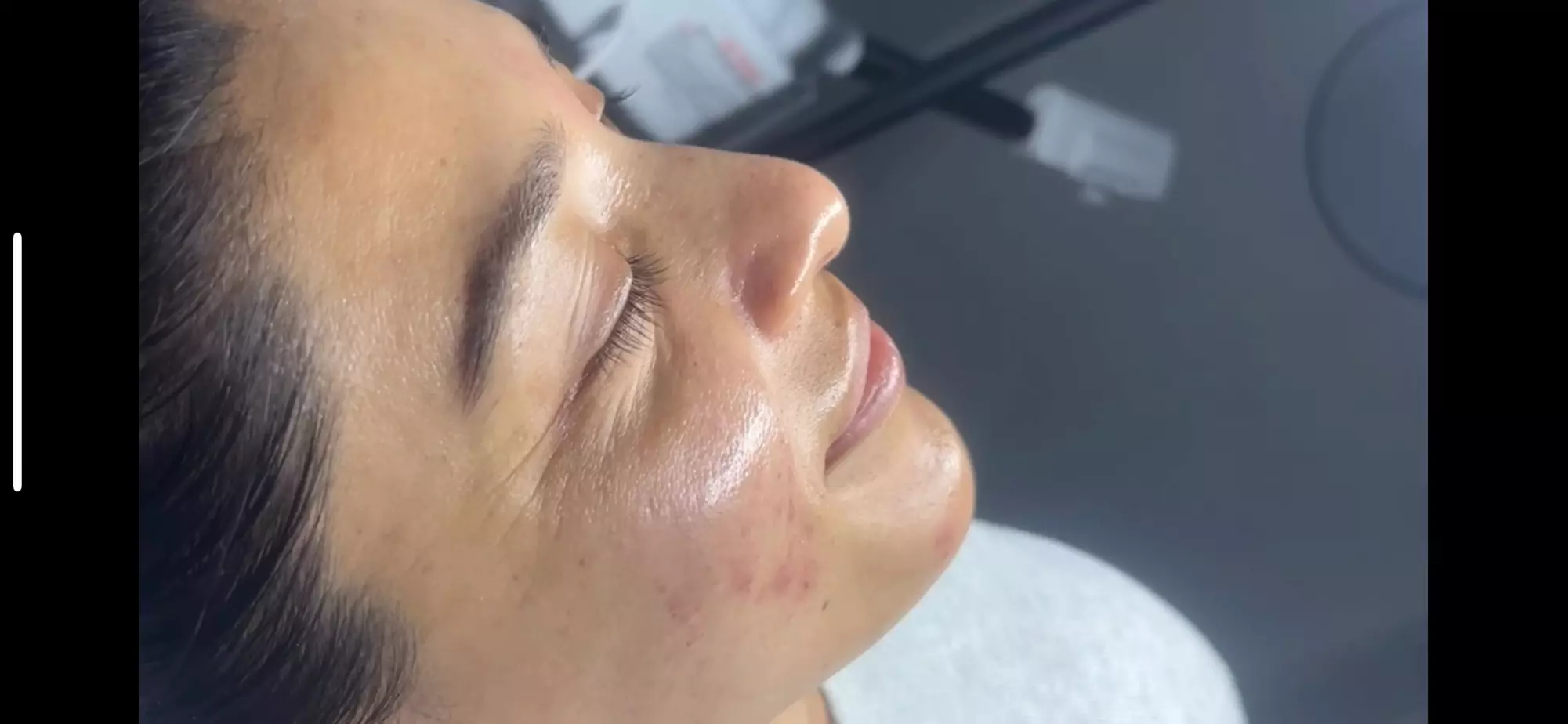 One or Three Non-Surgical Face Lift: RF, Ultrasound & Cryo LED Facial 