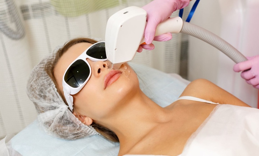 Image 1: Get 6 Laser Hair Removal Sessions on Small, Medium or Large Areas 