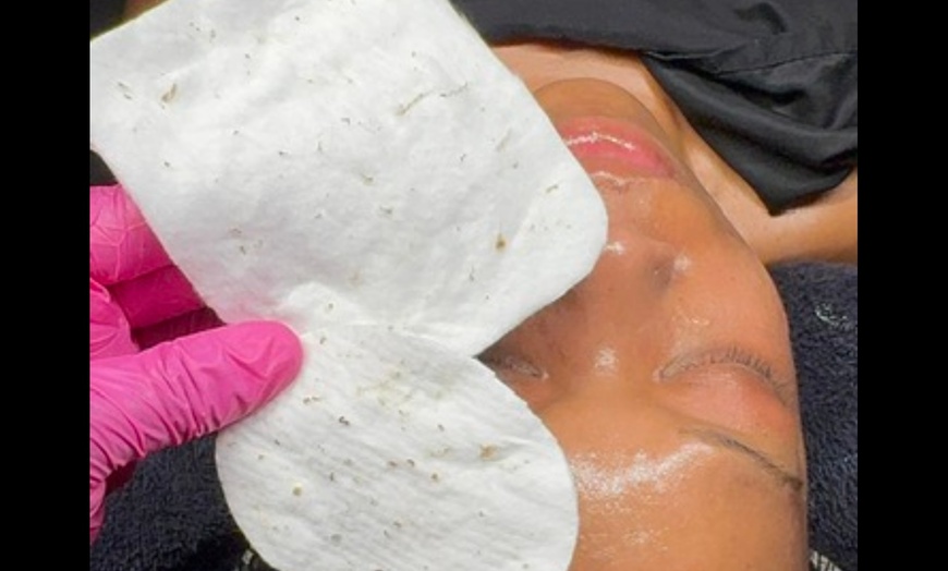 Image 4: Up to 62% Off on Microdermabrasion at Slayed Lounge And Beauty Bar