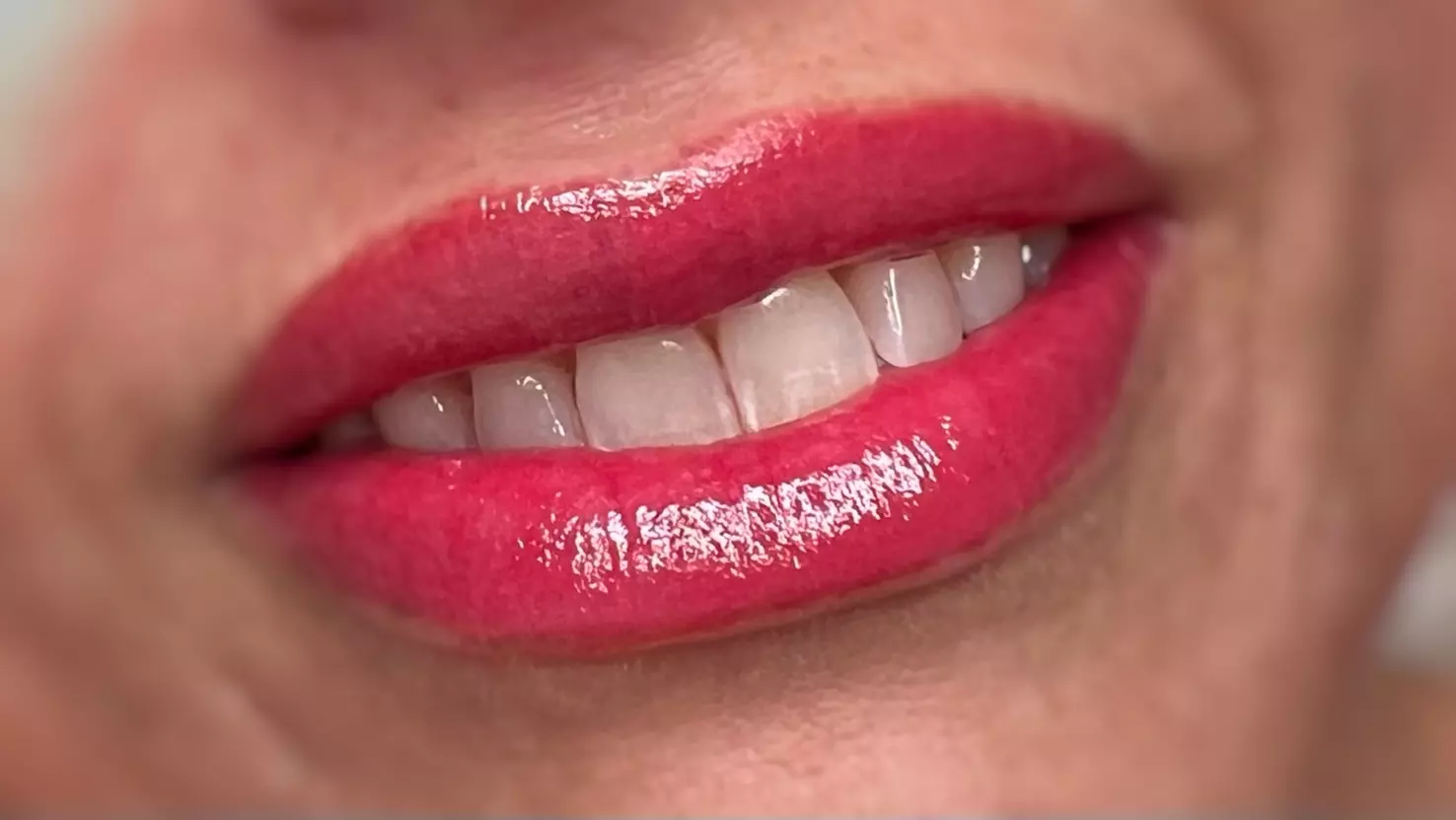 Transform Your Lips: Initial Lip Blush Treatment