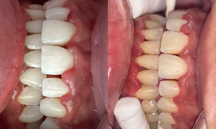 Tooth Gems ( Up to 4 Single Gems) - Exotic Aesthetics And Photography