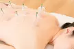 Deep Tissue Massages with Cupping & Postural Correction Up to 70% Off - Second Medium
