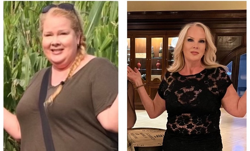 Image 3: 1, 3, or 6 Sessions of Radio Frequency Skin Tightening Treatments 