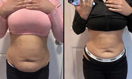 Five Non-Invasive Lipo 360 Ultrasonic Cavitation & Skin Tightening - Pretty Lyfe Esthetics