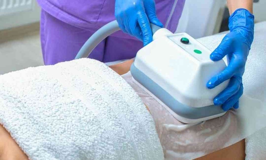 Image 1: Fat freezing for one or two areas using cold/hot technology