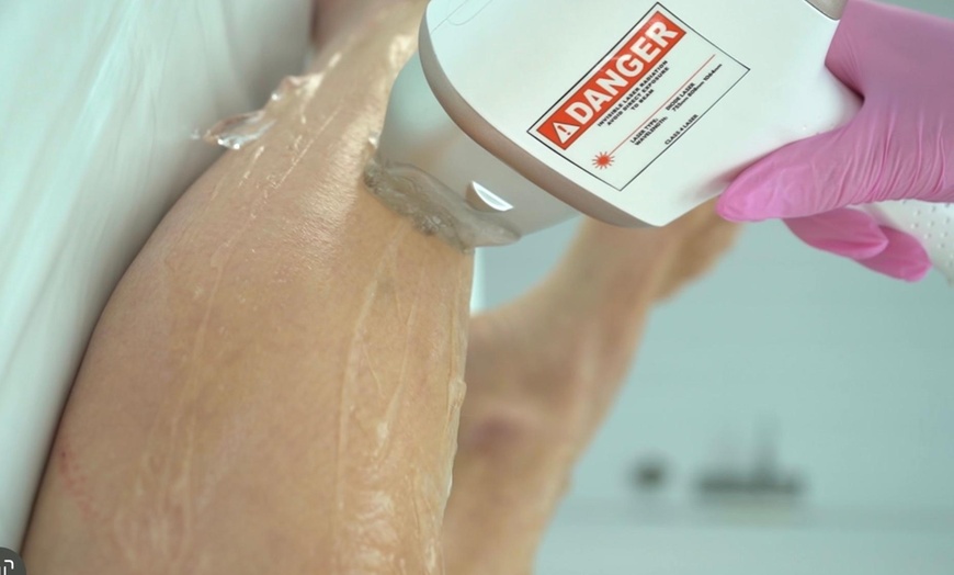 Image 8: Up to 80% Off on Laser Hair Removal at HL Lasers