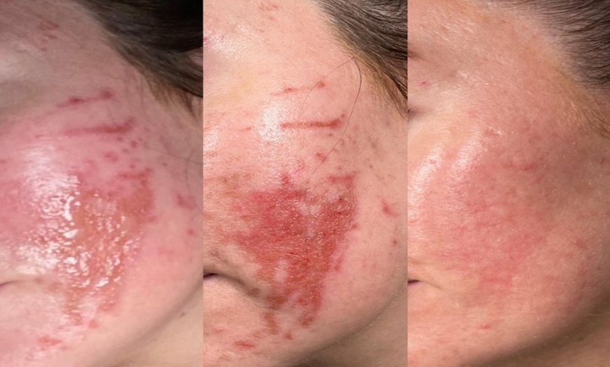Image 7: Achieve Radiance with 6, 10, or 20 Dermalux MD Triwave LED Therapy 