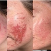 Image 7: Achieve Radiance with 6, 10, or 20 Dermalux MD Triwave LED Therapy 