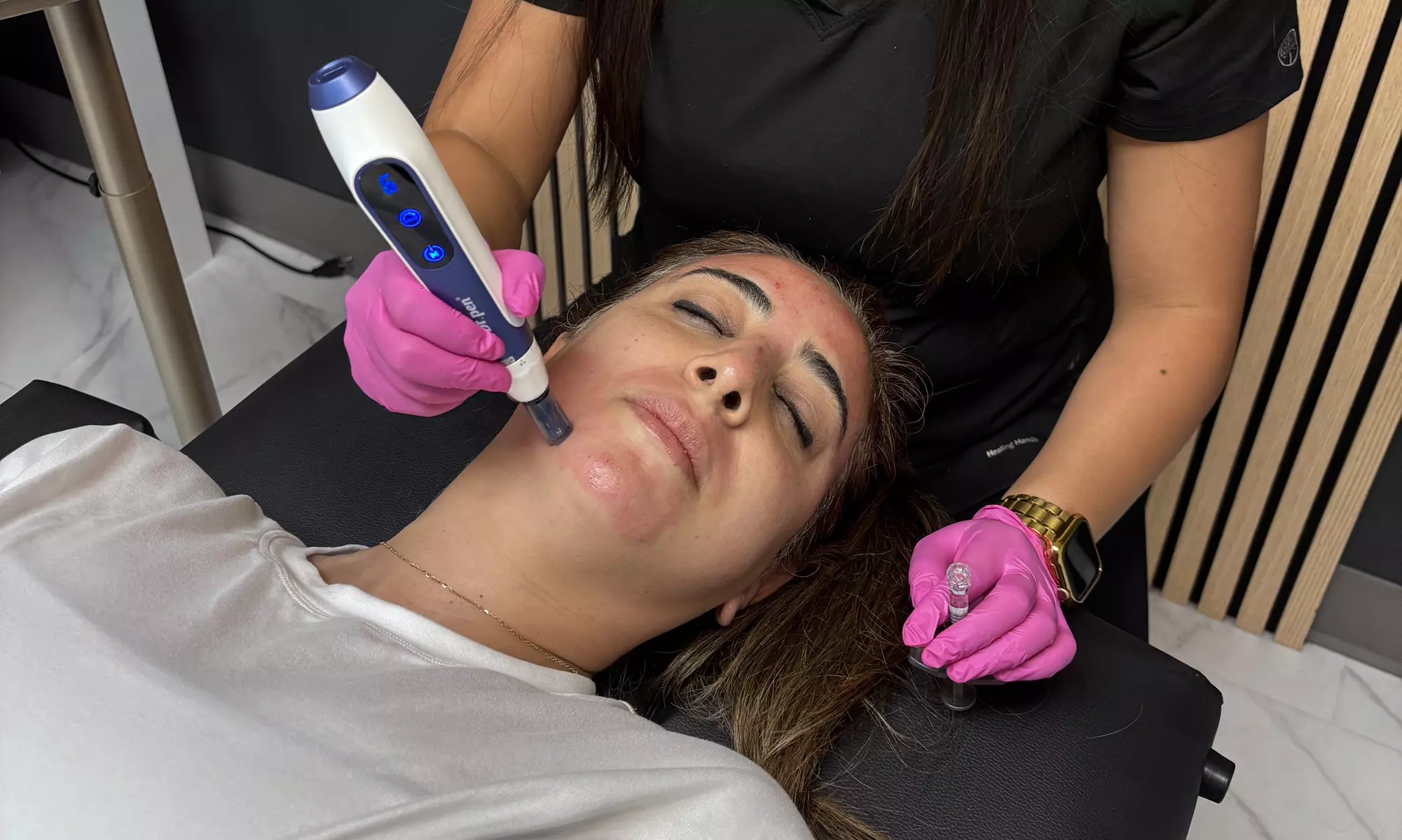 Glow & Rejuvenate at Luz Lounge Portland: Up to 30% Off Microneedling or PRP Combo for Smoother, Firmer Skin - Primary Image