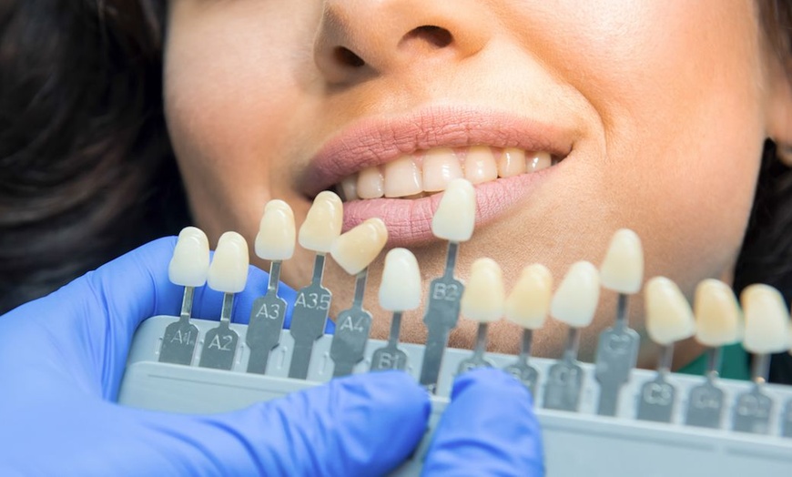 Image 3: Refresh Your Teeth with 30, 45, or 60-minute Teeth Whitening Treatment