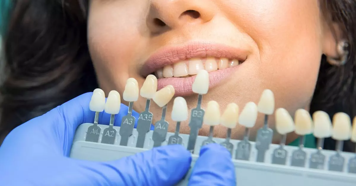 Refresh Your Teeth with 30, 45, or 60-minute Teeth Whitening Treatment