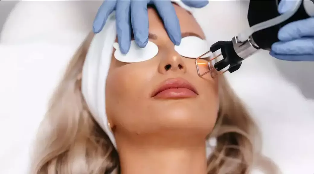 Get 1 or 3 CO2 Laser Skin Resurfacing For Acne Scars And Skin Tightening - Up to 72% Off - Second Medium