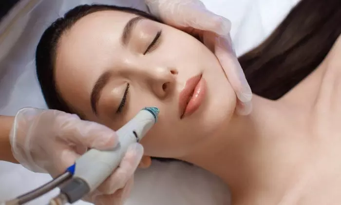 Up to 45% Off on HydraFacial at Beautymanors - Primary Image