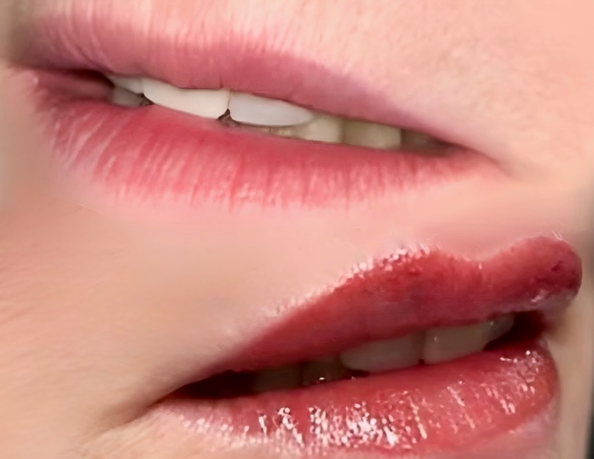 Achieve Flawless Lips with Professional Lip Blush