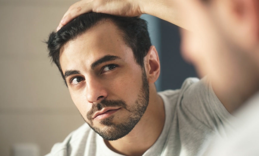 Image 2: 30 Min. PRP-Behandlung für Kopfhaut zur Anregung des Haarwachstums
