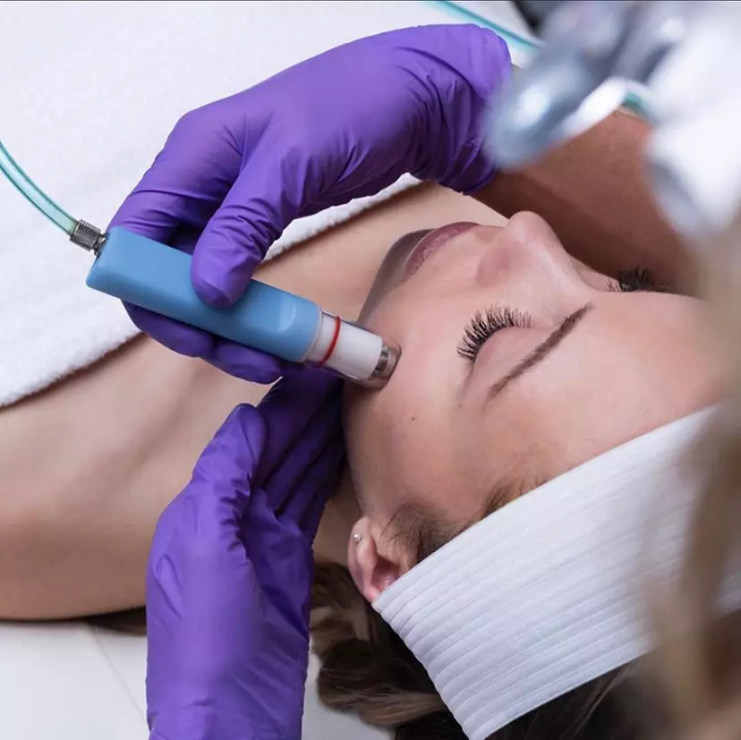 Experience the rejuvenating HydraFacial glow at McQueen Aesthetics with options including custom serums, LED therapy, and up to 35% off - Primary Image