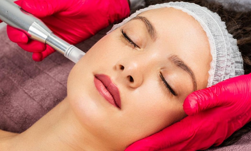 Image 1: Bis zu 66% Rabatt auf den Micro-Needling bei Ebru Aydin | Beauty & Laser Center