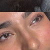Image 2: Transform Your Look: One Eyelash Lift Treatment with Optional Tinting