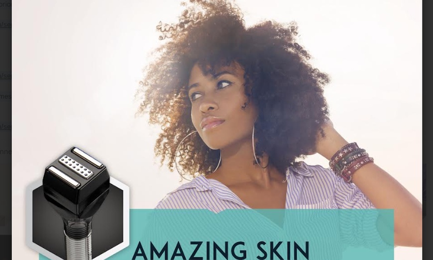 Image 2: Transform Your Skin: Forma RF for Face, Neck or Abdomen 